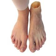 Luxmed Protez - Get Silicone prosthetic in Kazakhstan